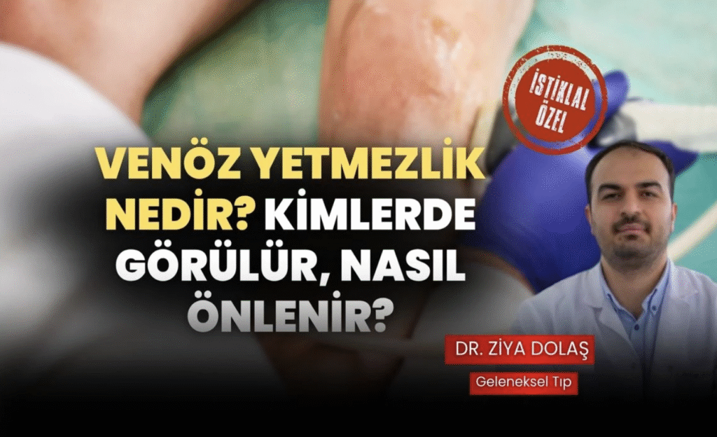 Venöz Yetmezlik Nedir? Kimlerde Görülür, Nasıl Önlenir?
