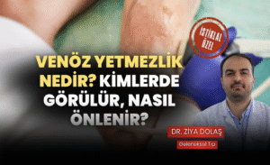 Venöz Yetmezlik Nedir? Kimlerde Görülür, Nasıl Önlenir?